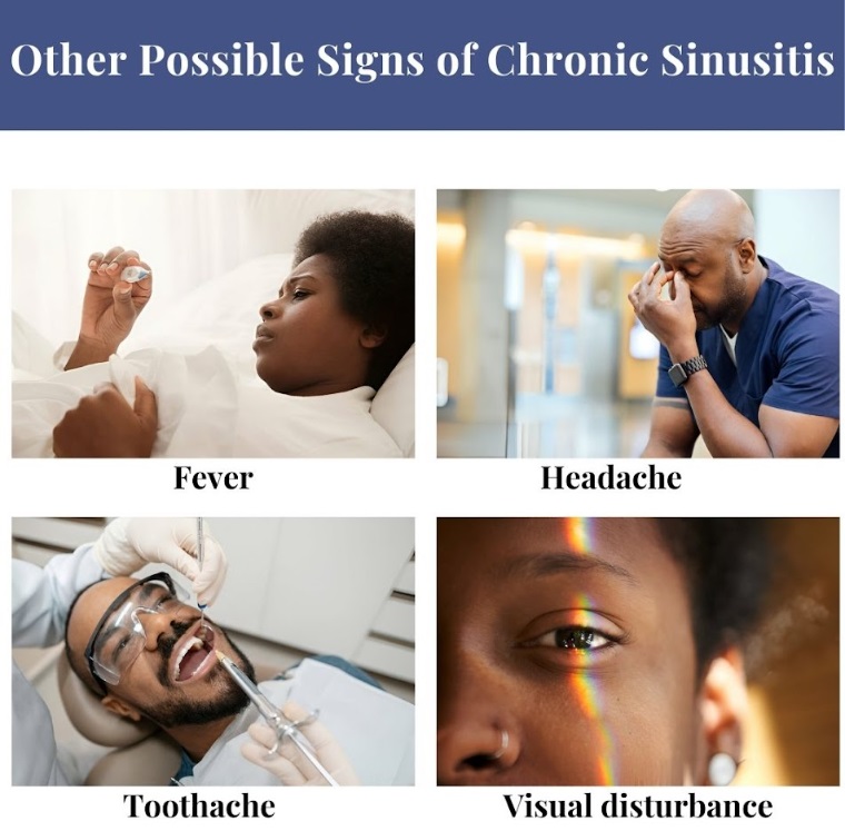 A composite illustration of other signs of chronic sinusitisPossi